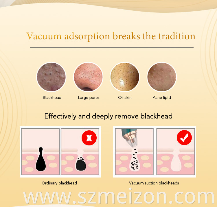 Blackhead Remover for all skins